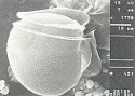 Dinophysis rotundata