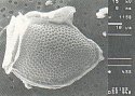 Dinophysis norvegica